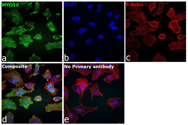 MYO10 Antibody in Immunocytochemistry (ICC/IF)