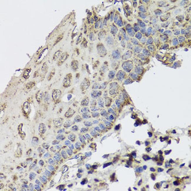 GBF1 Antibody in Immunohistochemistry (Paraffin) (IHC (P))