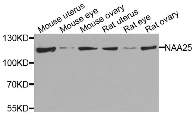 C12orf30 Antibody in Western Blot (WB)