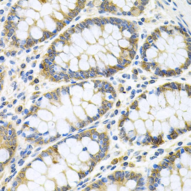 GNE Antibody in Immunohistochemistry (Paraffin) (IHC (P))