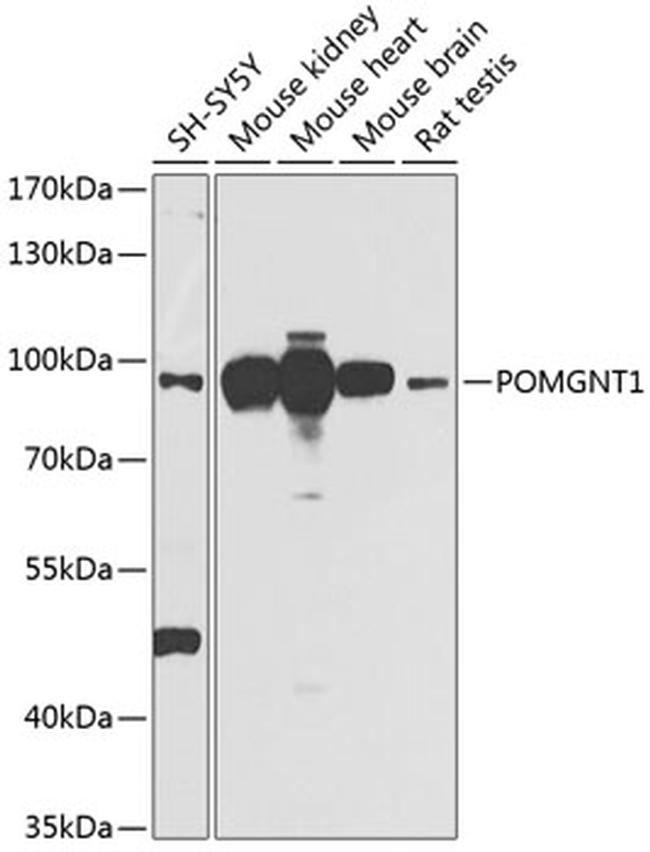 POMGNT1 Antibody in Western Blot (WB)