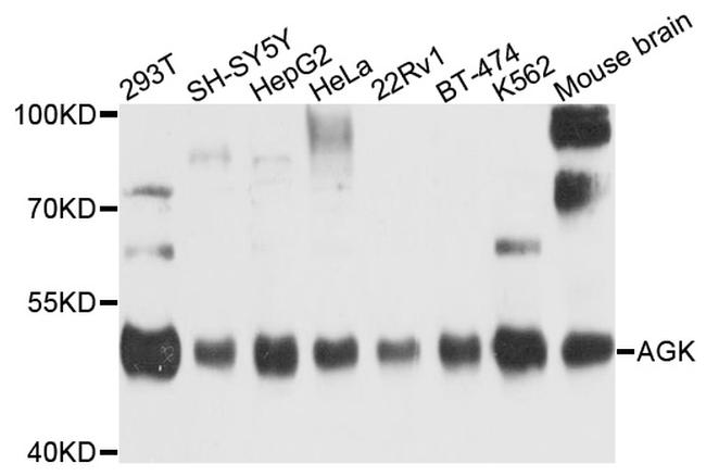 AGK Antibody in Western Blot (WB)