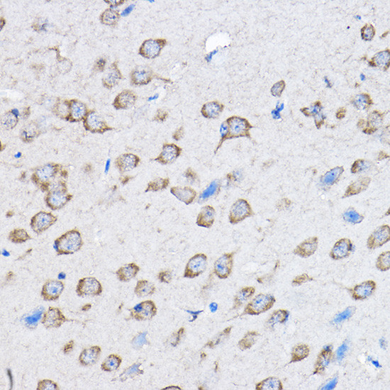 PTPN23 Antibody in Immunohistochemistry (Paraffin) (IHC (P))