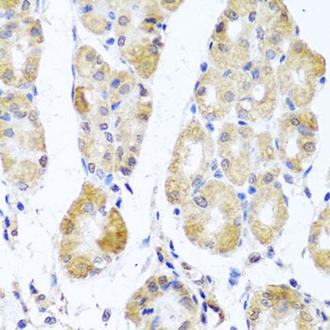 MRPL11 Antibody in Immunohistochemistry (Paraffin) (IHC (P))