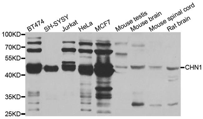 CHN1 Antibody in Western Blot (WB)