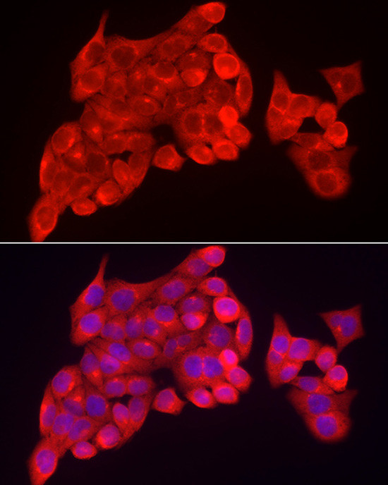 SKIP Antibody in Immunocytochemistry (ICC/IF)