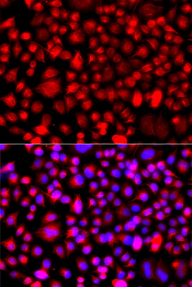 ALG1 Antibody in Immunocytochemistry (ICC/IF)