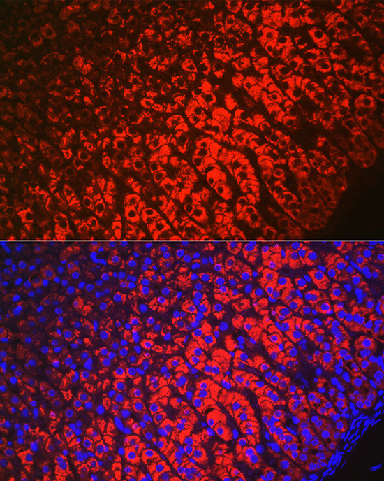 HSD3B1 Antibody in Immunocytochemistry (ICC/IF)