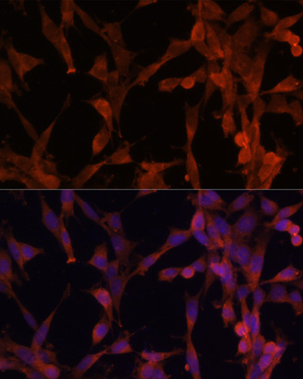 UBE2G2 Antibody in Immunocytochemistry (ICC/IF)