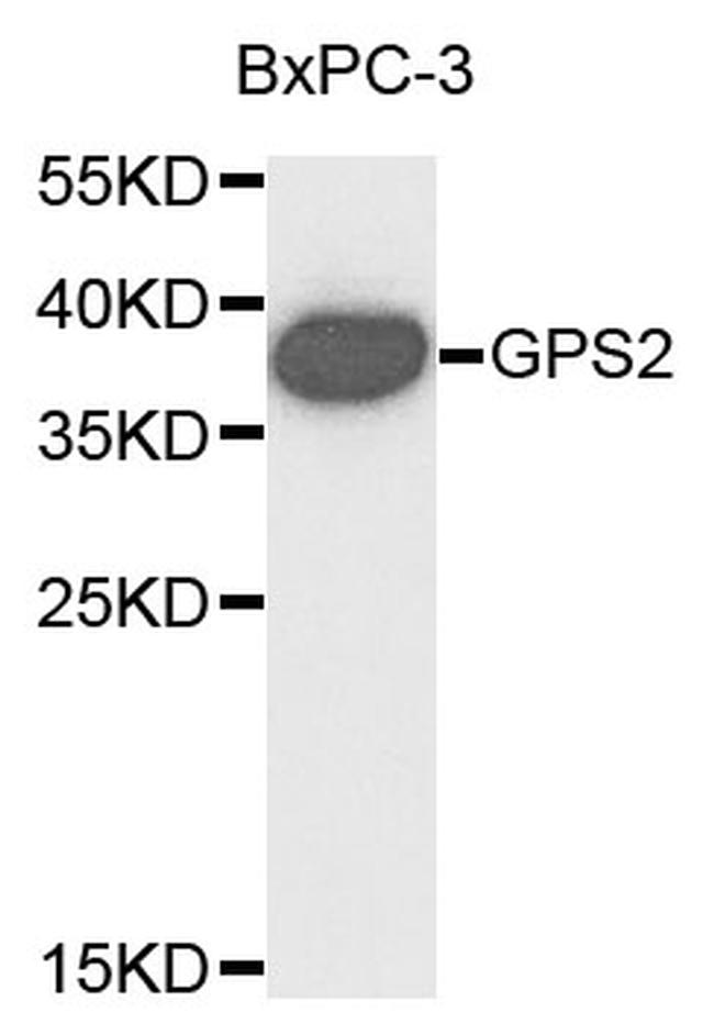 GPS2 Antibody in Western Blot (WB)