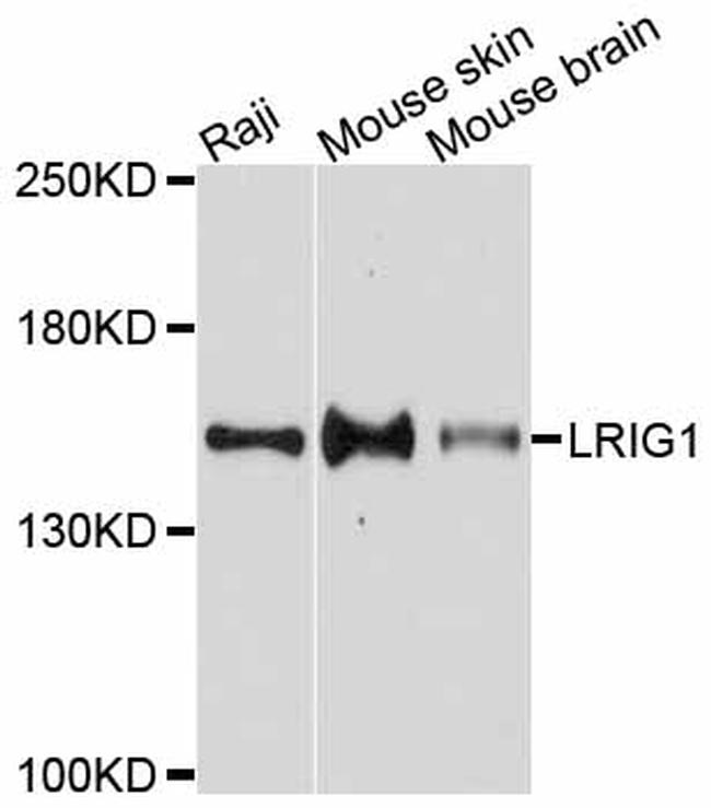 LRIG1 Antibody in Western Blot (WB)