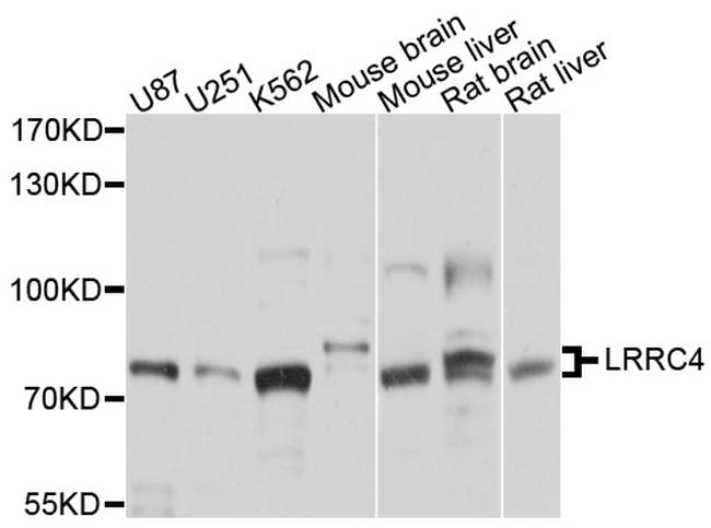 LRRC4 Antibody in Western Blot (WB)