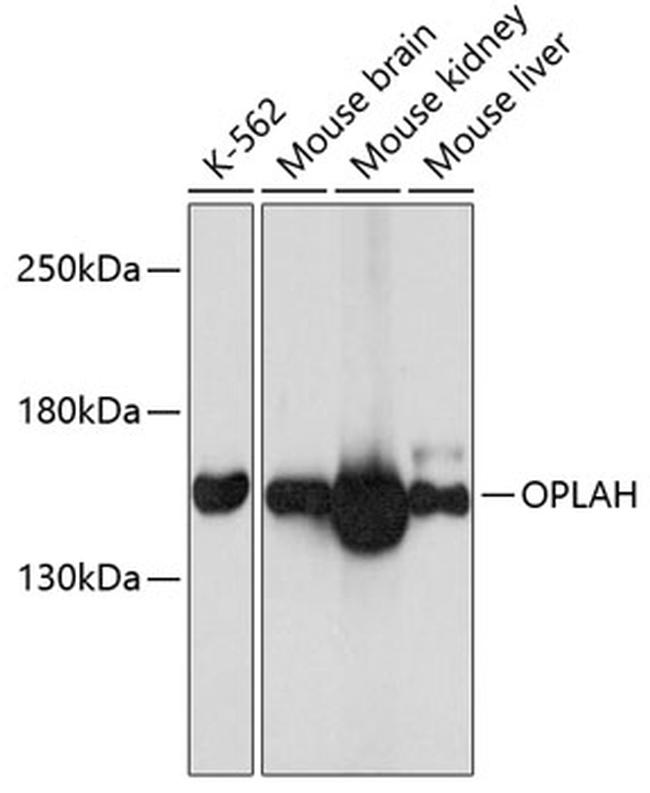 OPLAH Antibody in Western Blot (WB)