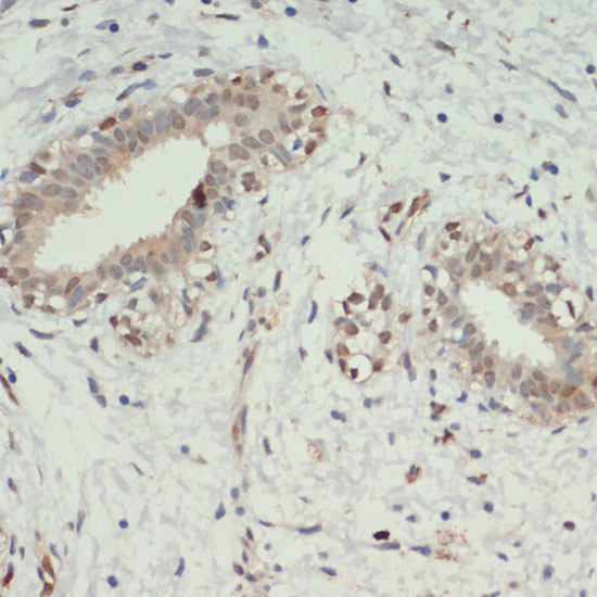 KDM6A Antibody in Immunohistochemistry (Paraffin) (IHC (P))