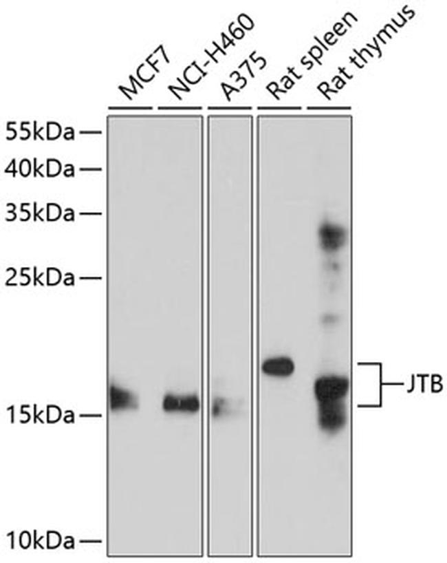 JTB Antibody in Western Blot (WB)