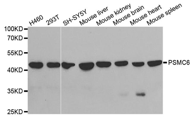 PSMC6 Antibody in Western Blot (WB)