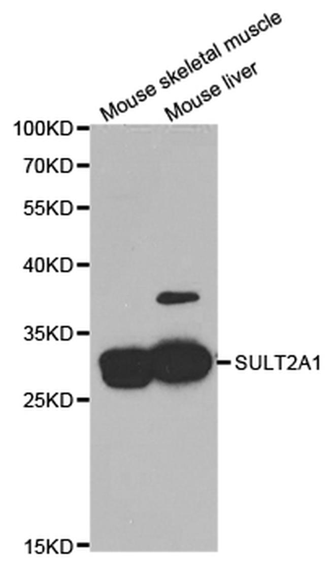 SULT2A1 Antibody in Western Blot (WB)