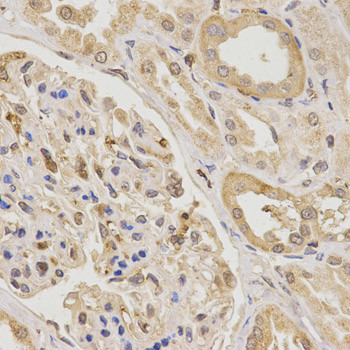 UTS2 Antibody in Immunohistochemistry (Paraffin) (IHC (P))