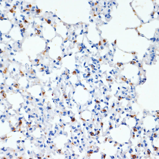 SFTPC Antibody in Immunohistochemistry (Paraffin) (IHC (P))