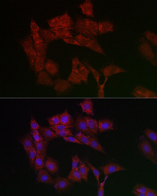 ANT Antibody in Immunocytochemistry (ICC/IF)