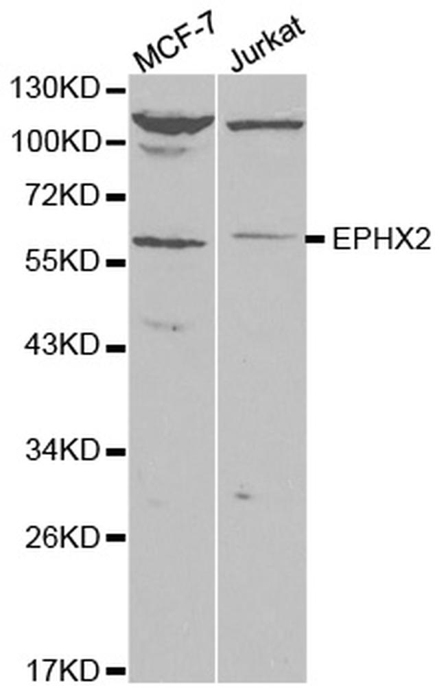 EPHX2 Antibody in Western Blot (WB)