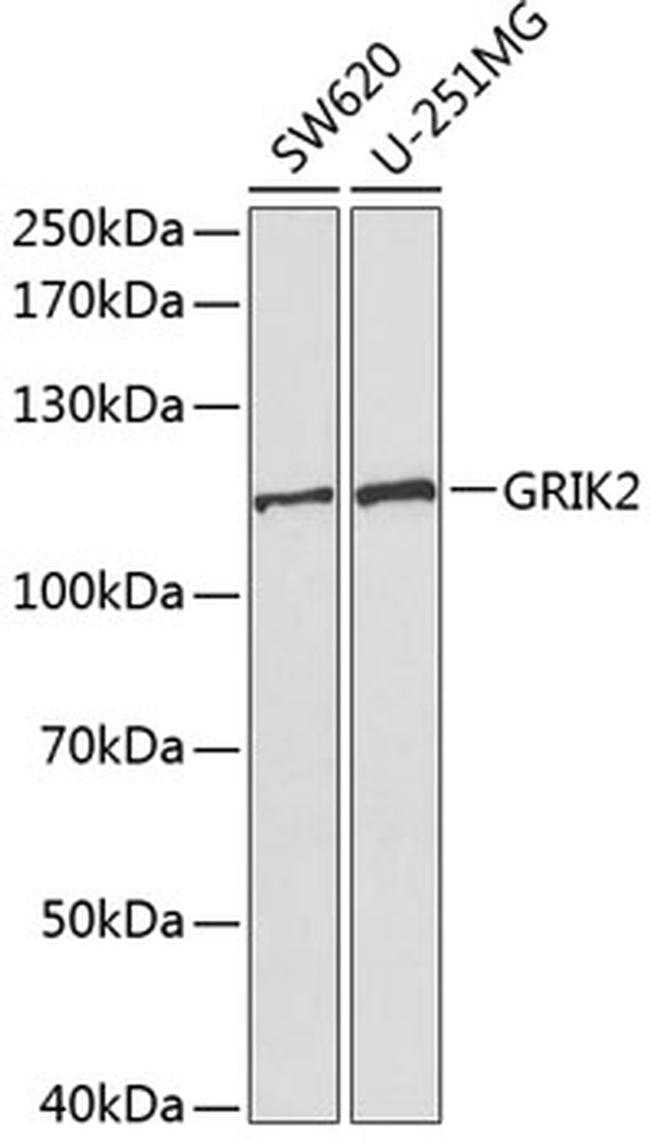 GluR6 Antibody in Western Blot (WB)