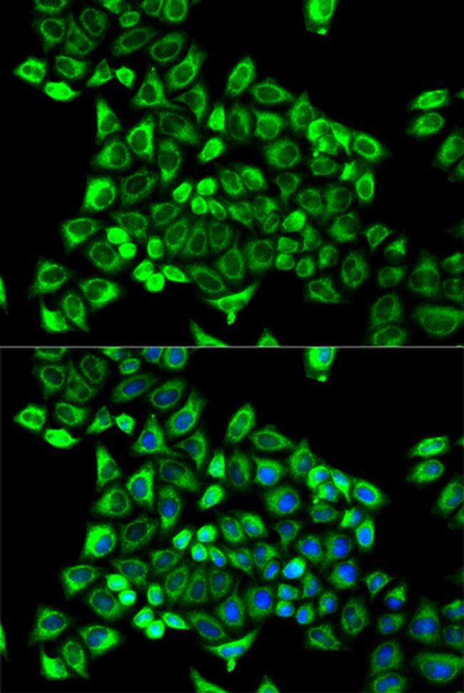 CDA Antibody in Immunocytochemistry (ICC/IF)