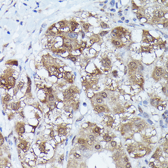 MT2A Antibody in Immunohistochemistry (Paraffin) (IHC (P))