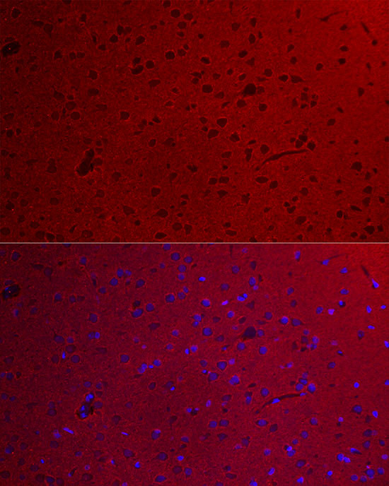 GNAO1 Antibody in Immunocytochemistry (ICC/IF)