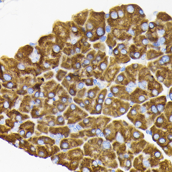 RPS3 Antibody in Immunohistochemistry (Paraffin) (IHC (P))