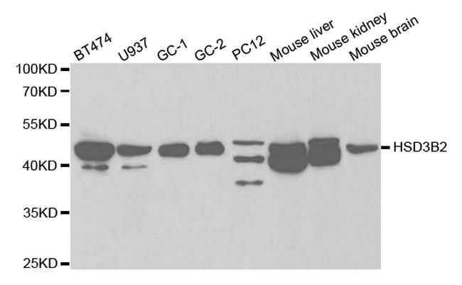 HSD3B2 Antibody in Western Blot (WB)