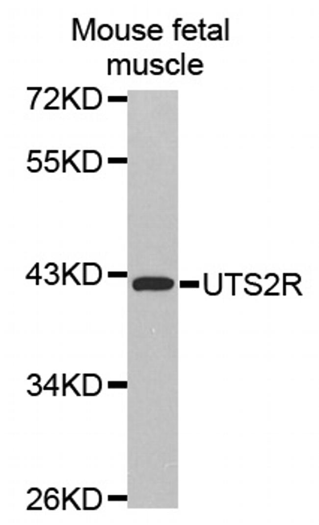 Urotensin II Receptor Antibody in Western Blot (WB)