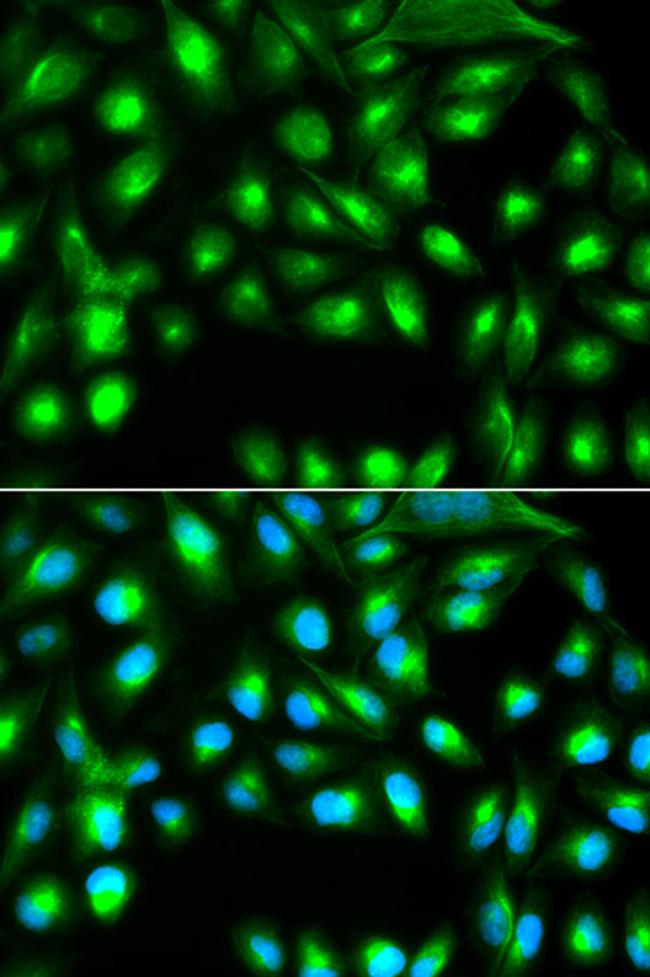 Gemin 2 Antibody in Immunocytochemistry (ICC/IF)