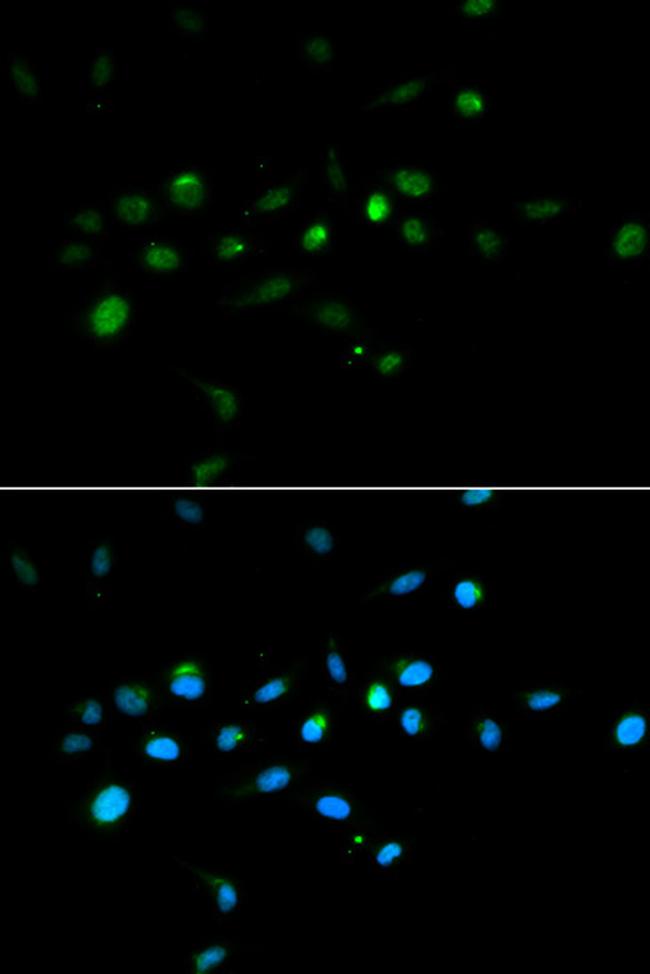 MURF1 Antibody in Immunocytochemistry (ICC/IF)