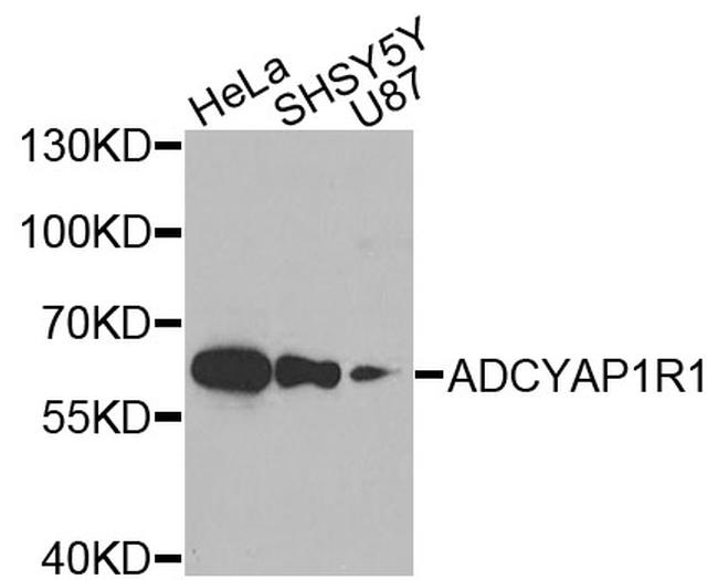 PACAP Receptor Antibody in Western Blot (WB)