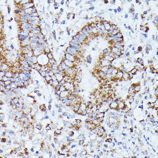 PP2A beta Antibody in Immunohistochemistry (Paraffin) (IHC (P))