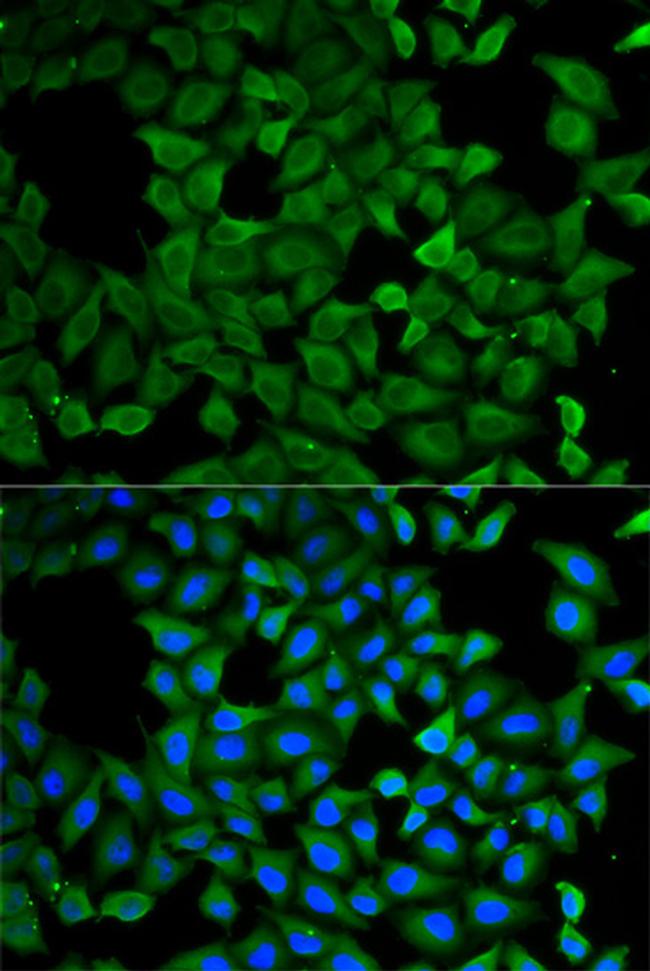 ATL1 Antibody in Immunocytochemistry (ICC/IF)