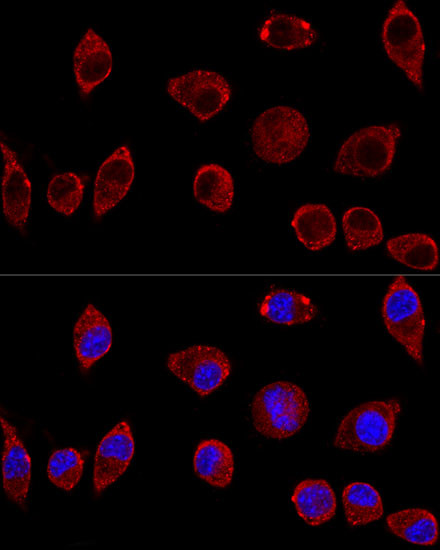 DAO Antibody in Immunocytochemistry (ICC/IF)