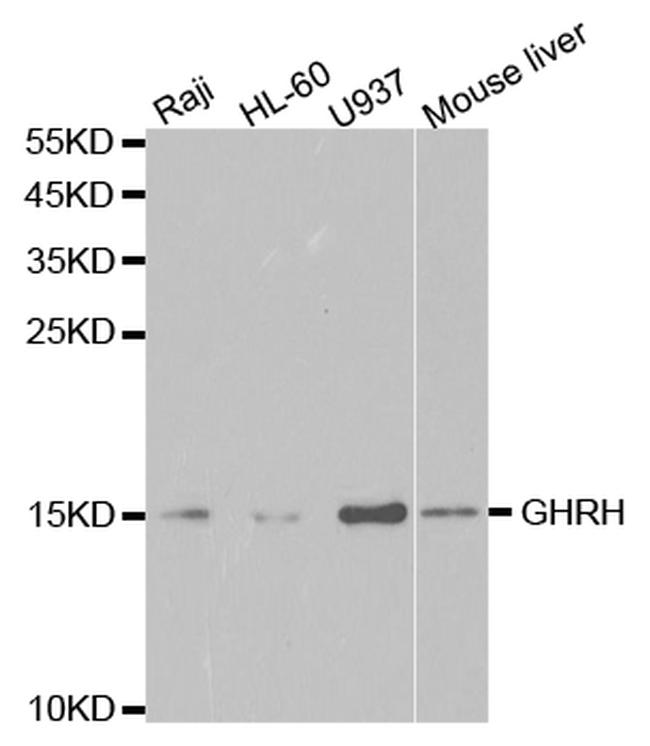 GHRH Antibody in Western Blot (WB)