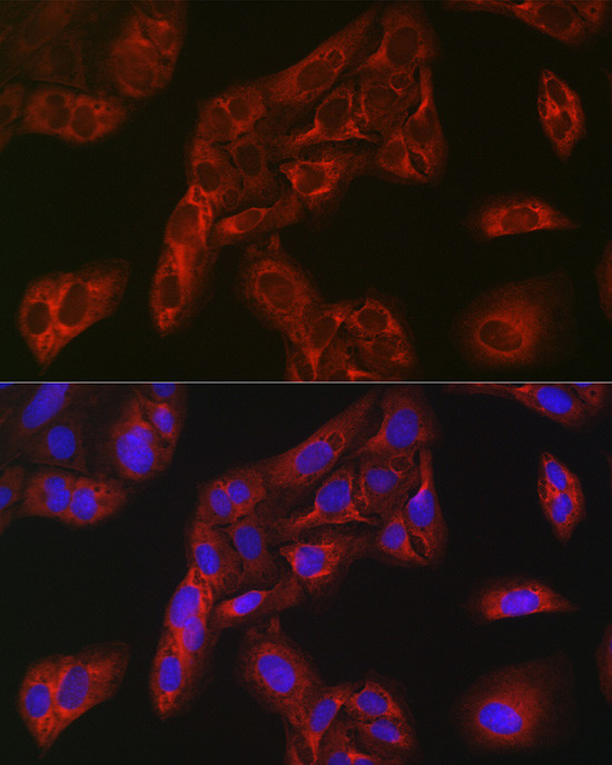 FBP1 Antibody in Immunocytochemistry (ICC/IF)