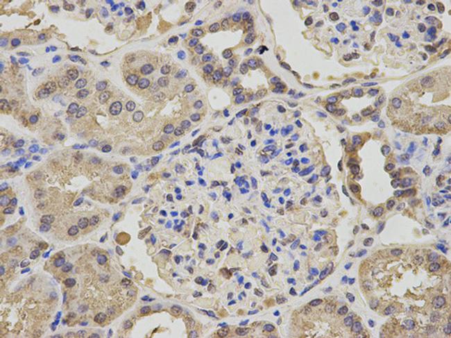 NPC2 Antibody in Immunohistochemistry (Paraffin) (IHC (P))