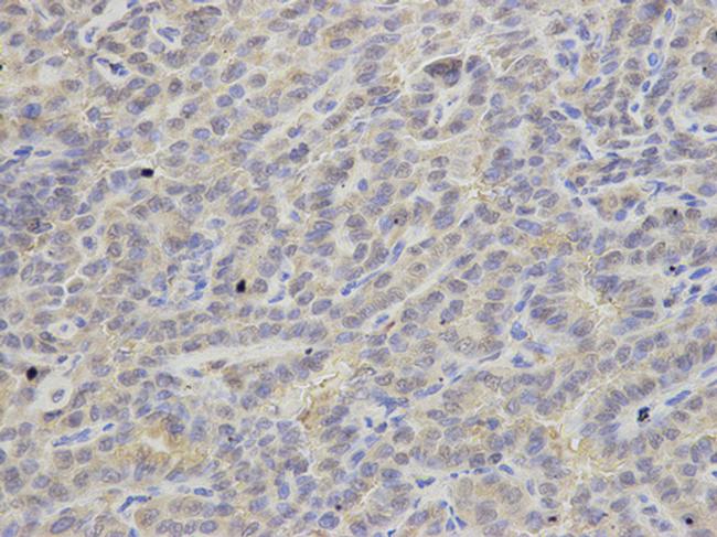 APRT Antibody in Immunohistochemistry (Paraffin) (IHC (P))