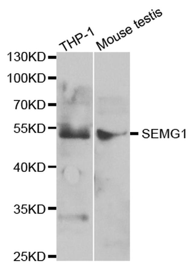 SEMG1 Antibody in Western Blot (WB)