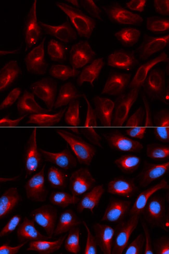 TLE1 Antibody in Immunocytochemistry (ICC/IF)