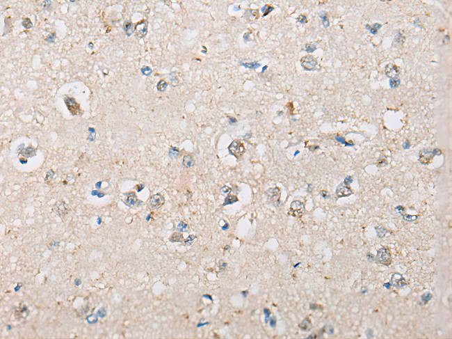 UGT1A4 Antibody in Immunohistochemistry (Paraffin) (IHC (P))