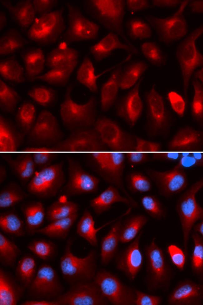 KLC1 Antibody in Immunocytochemistry (ICC/IF)