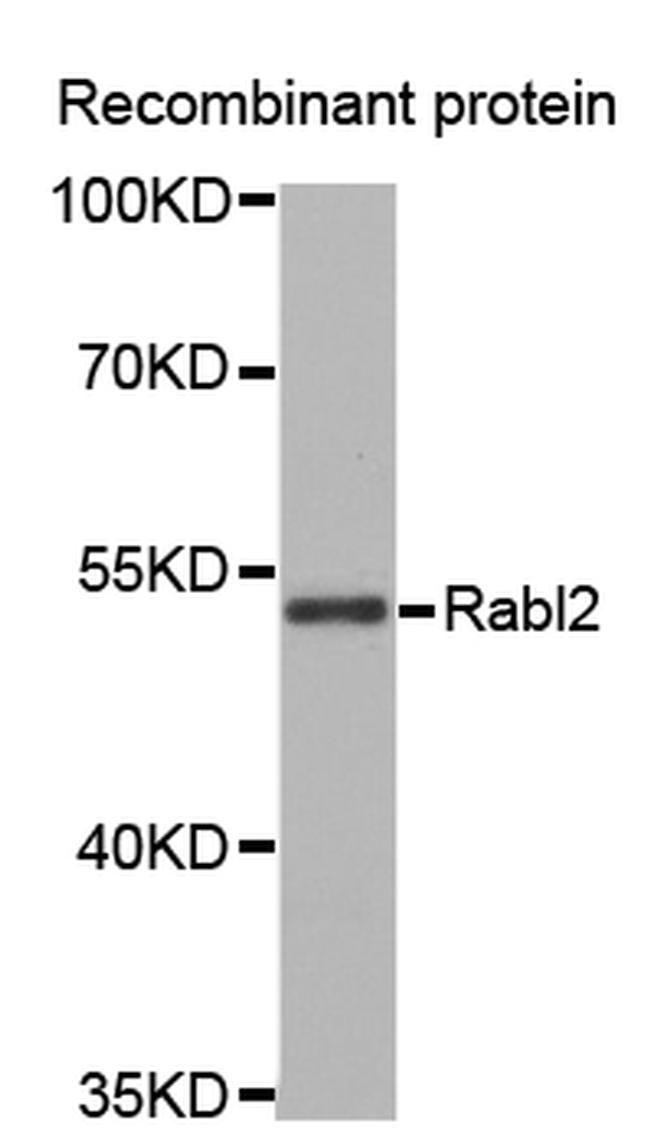 RABL2A Antibody in Western Blot (WB)