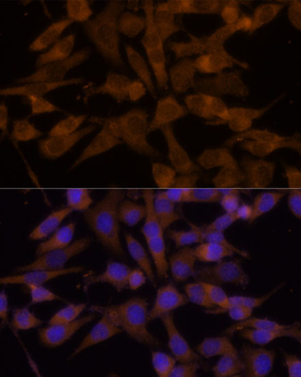 UGT2B7 Antibody in Immunocytochemistry (ICC/IF)