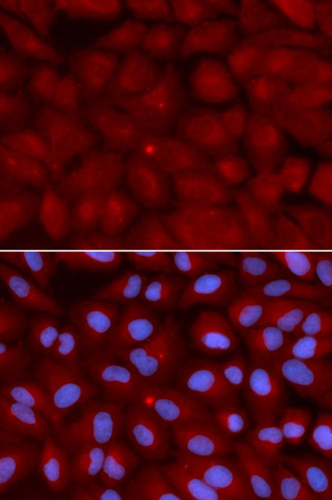 BIN1 Antibody in Immunocytochemistry (ICC/IF)