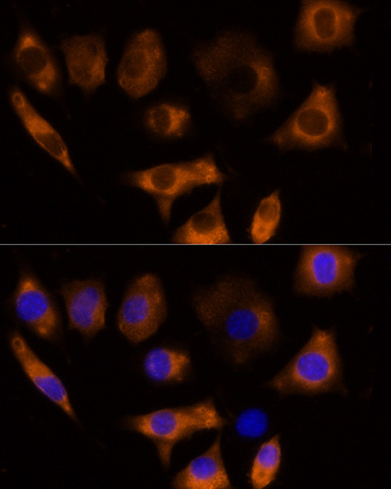 Calpain 3 Antibody in Immunocytochemistry (ICC/IF)